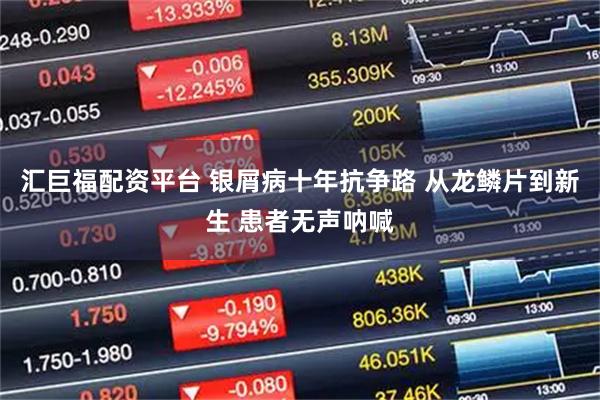 汇巨福配资平台 银屑病十年抗争路 从龙鳞片到新生 患者无声呐喊